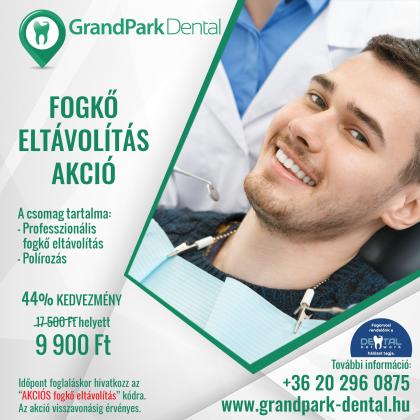 Fogkő eltávolítás AKCIÓ Fogkő eltávolítás AKCIÓ