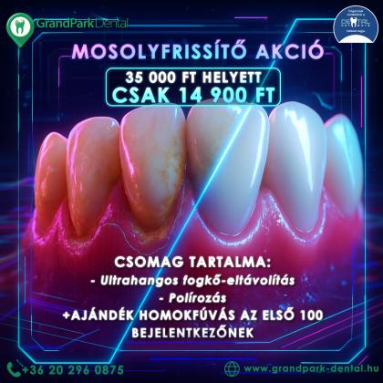 Mosolyfrissítő Akció