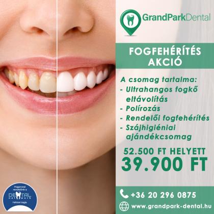 Fogfehérítés AKCIÓ